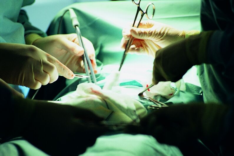 Surgical increase in penis thickness